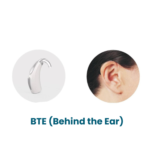 BTE-Behind-the-Ear.png